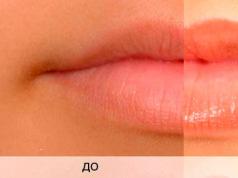 Lūpu kopšana pēc permanentā grima procedūras